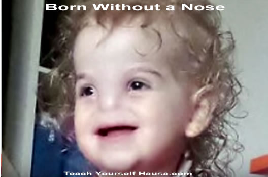 Born without a nose